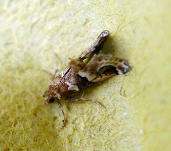 Asopie corticale